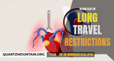 Understanding the Travel Restrictions for Individuals with Blood Clots in the Lungs