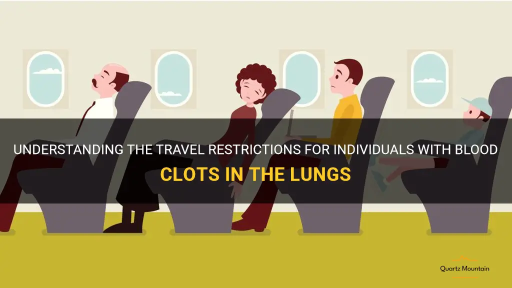 blood clot in lung travel restrictions