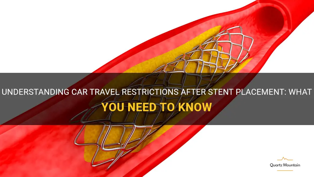 car travel restrictions after stent