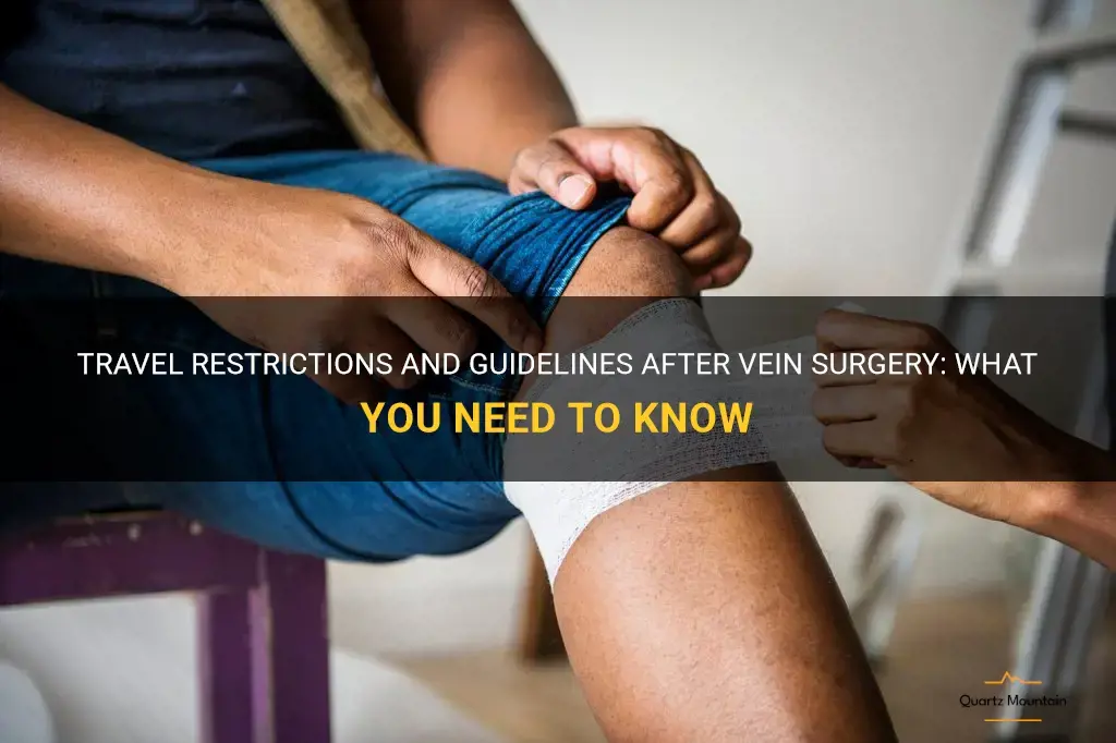 is travel restricted after vein surgery