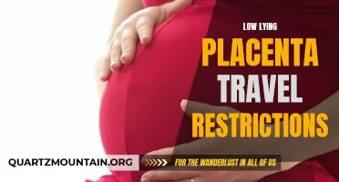Navigating Travel Restrictions with a Low-Lying Placenta: What You Need to Know
