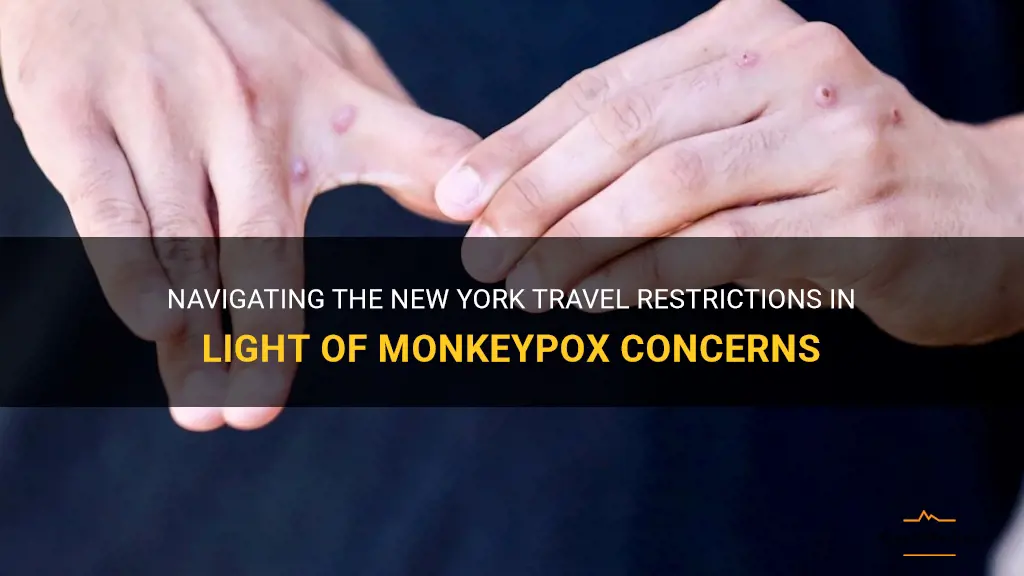 new york travel restrictions monkeypox