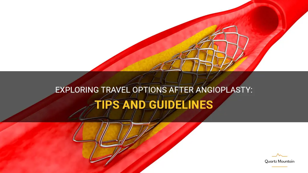 travel restrictions after angioplasty