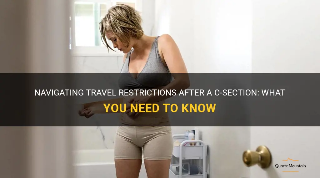 travel restrictions after c section