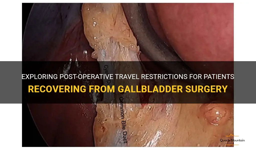 travel restrictions after gallbladder surgery