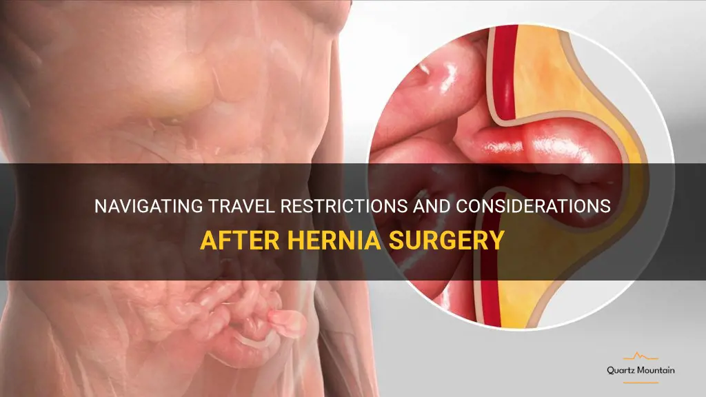 travel restrictions after hernia surgery