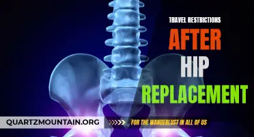 Navigating Travel Restrictions After Hip Replacement Surgery: What You Need to Know