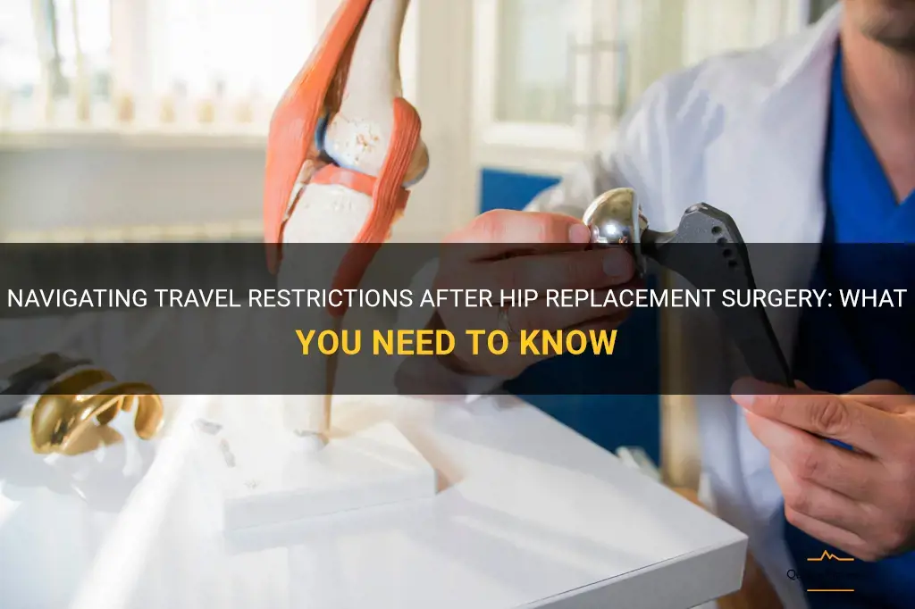 travel restrictions after hip replacement