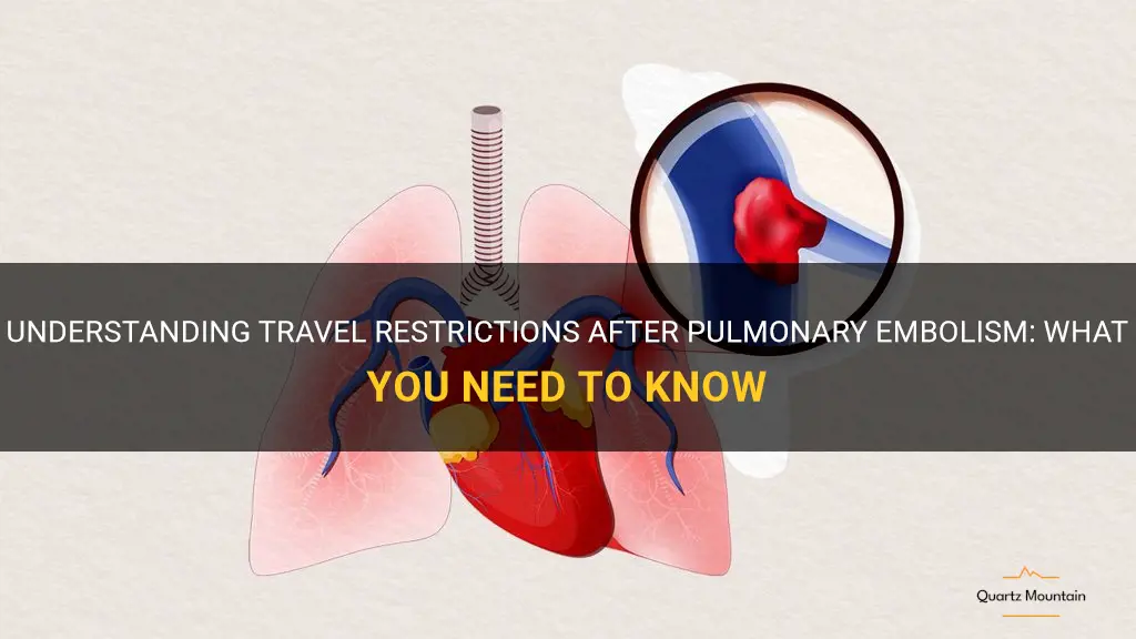 travel restrictions after pulmonary embolism