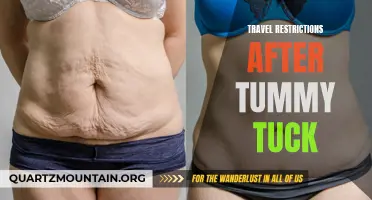 Navigating Travel Restrictions After a Tummy Tuck: What You Need to Know