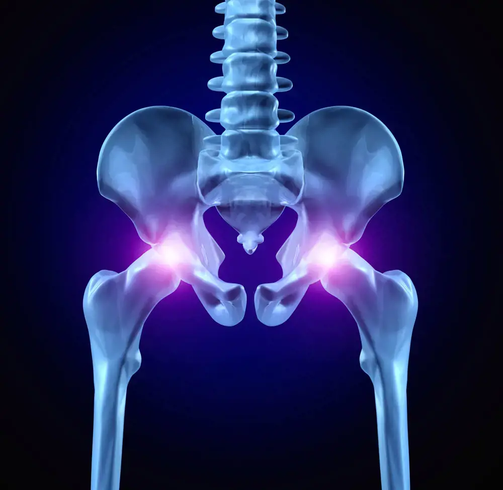 hip replacement travel restrictions
